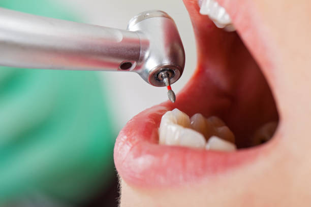 Best Emergency Dentist for Knocked-Out Tooth in Platteville, WI